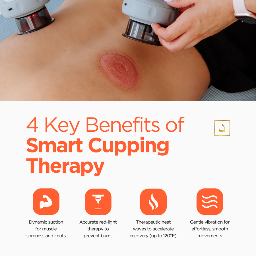 Kop Smart Cupping Therapy : système moderne de soulagement de la douleur et de récupération