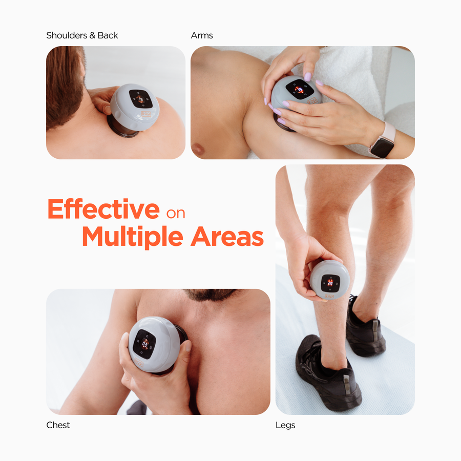 Kop Smart Cupping Therapy : système moderne de soulagement de la douleur et de récupération